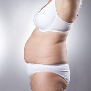 Liposuction vs. Liposculpture: What's the Difference?